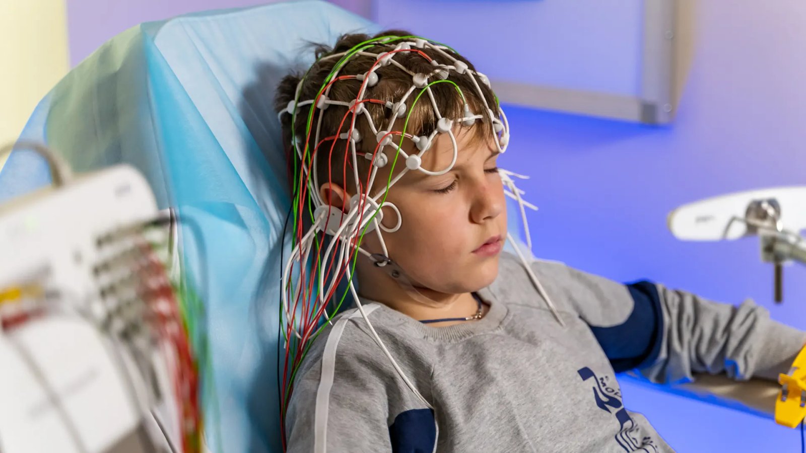 Gangguan saraf pada anak